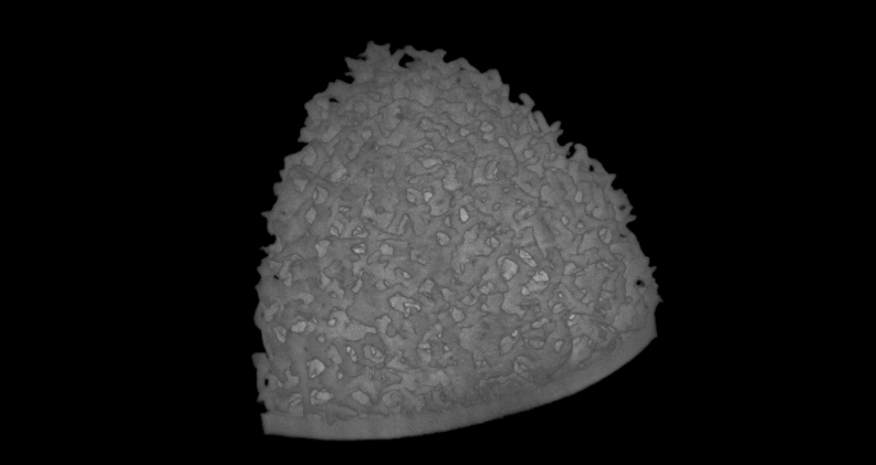 rms-3-dimensional-reconstruction-CT-Scan-AM